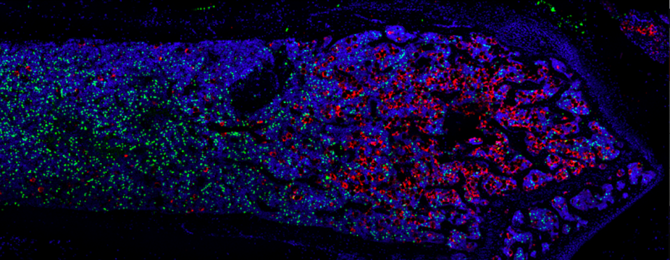 Confocal image of bone marrow cells